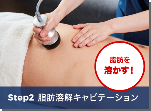 Step2 脂肪溶解キャビテーション